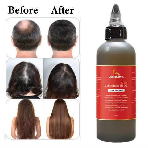 Quirkova Hair Growth Oil